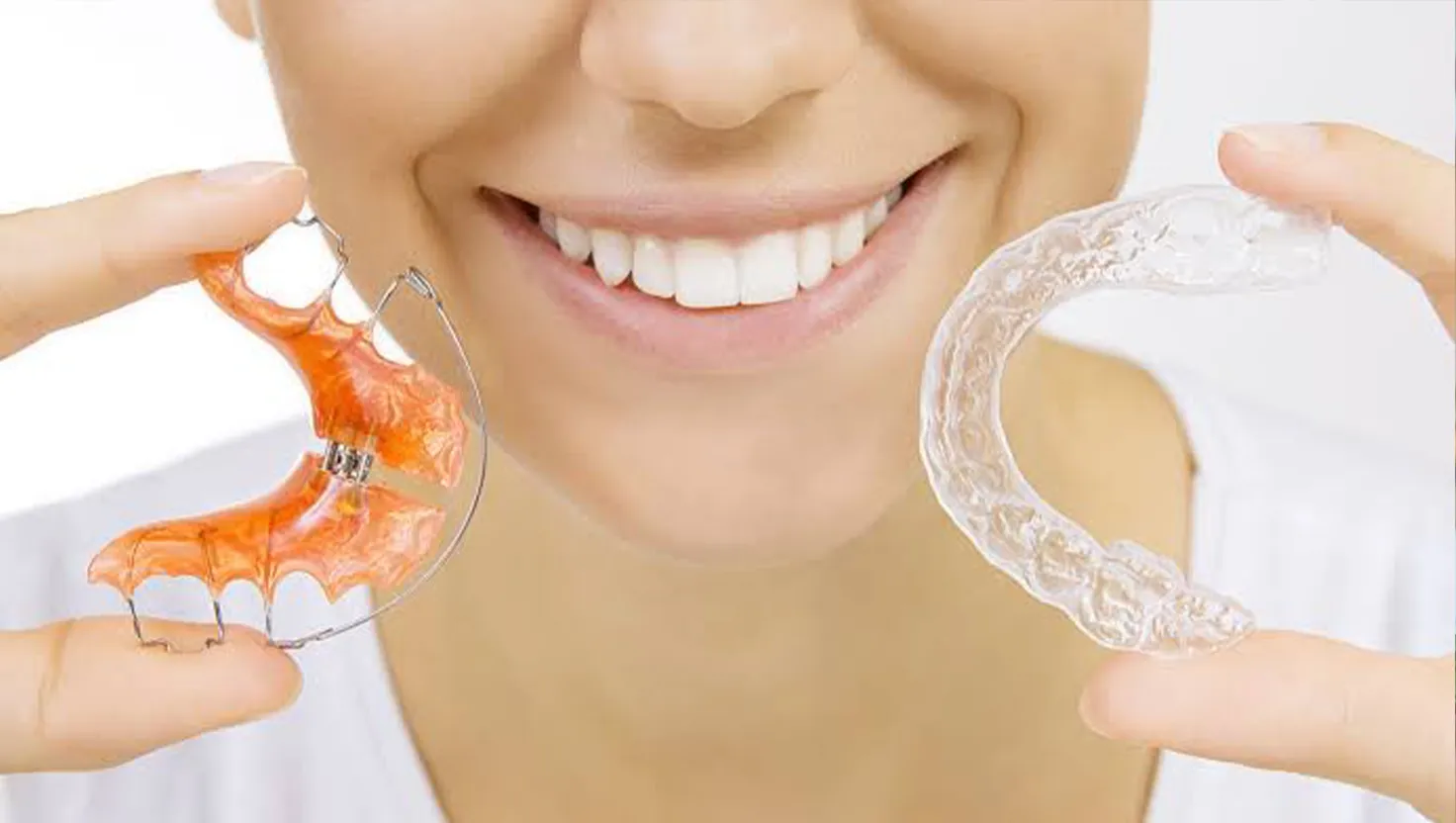 نگهدارنده یا ریتینر ارتودنسی چیست
